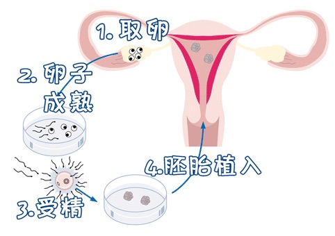 嘉和优生